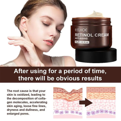 Crème éclaircissante au beurre de perle pour le visage, élimine les taches de rousseur, réduit les taches sombres, cosmétique blanchissant de beauté pour les soins du visage, crème à la perle