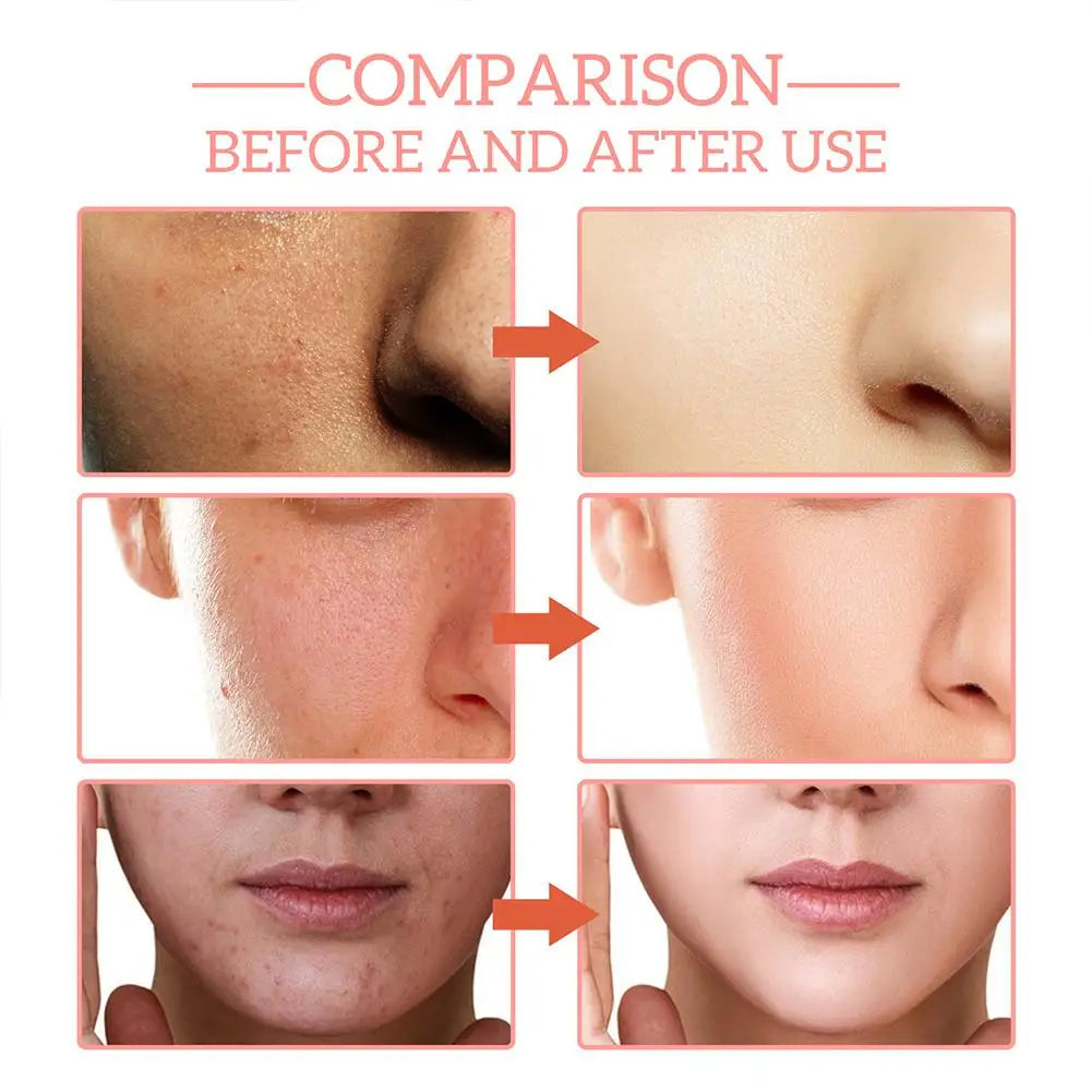 Sérum visage raffermissant 5 en 1 pour estomper les ridules, hydratant et éclaircissant, sérum facial à la vitamine C et à l’acide hyaluronique, resserre les pores, soin de la peau