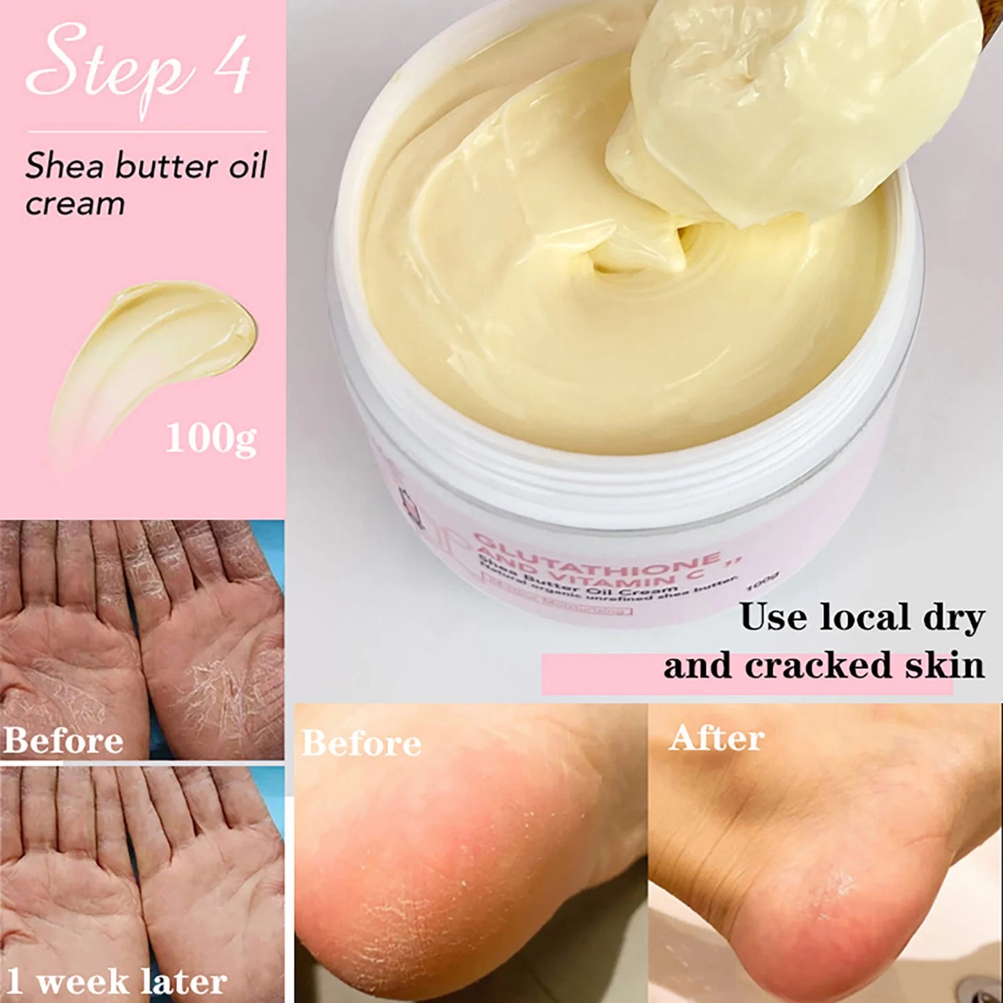 Crème de soin éclaircissante pour la peau AILKE, lotion éclaircissante, élimine les taches foncées avec glutathion, beurre de karité, crème corporelle hydratante